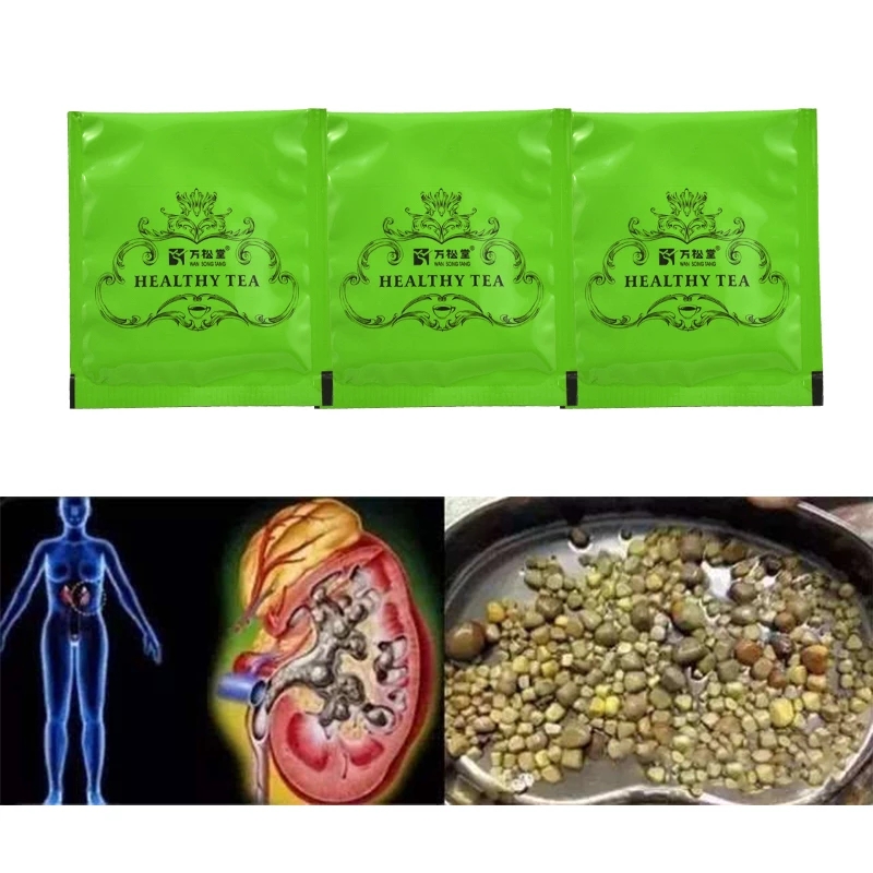 20 pcs/1 Packs Kidney Stones Cleaning Drink Tea Chinese medicine Kidney Care treatment Excreting kidney toxins cleaning product