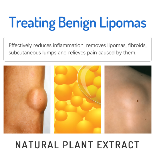 Body Care Cream Reduce Swelling Stimulate Blood Circulation Relieve Body Discomfort Detoxifying Nourishing Leg Repair Ointment