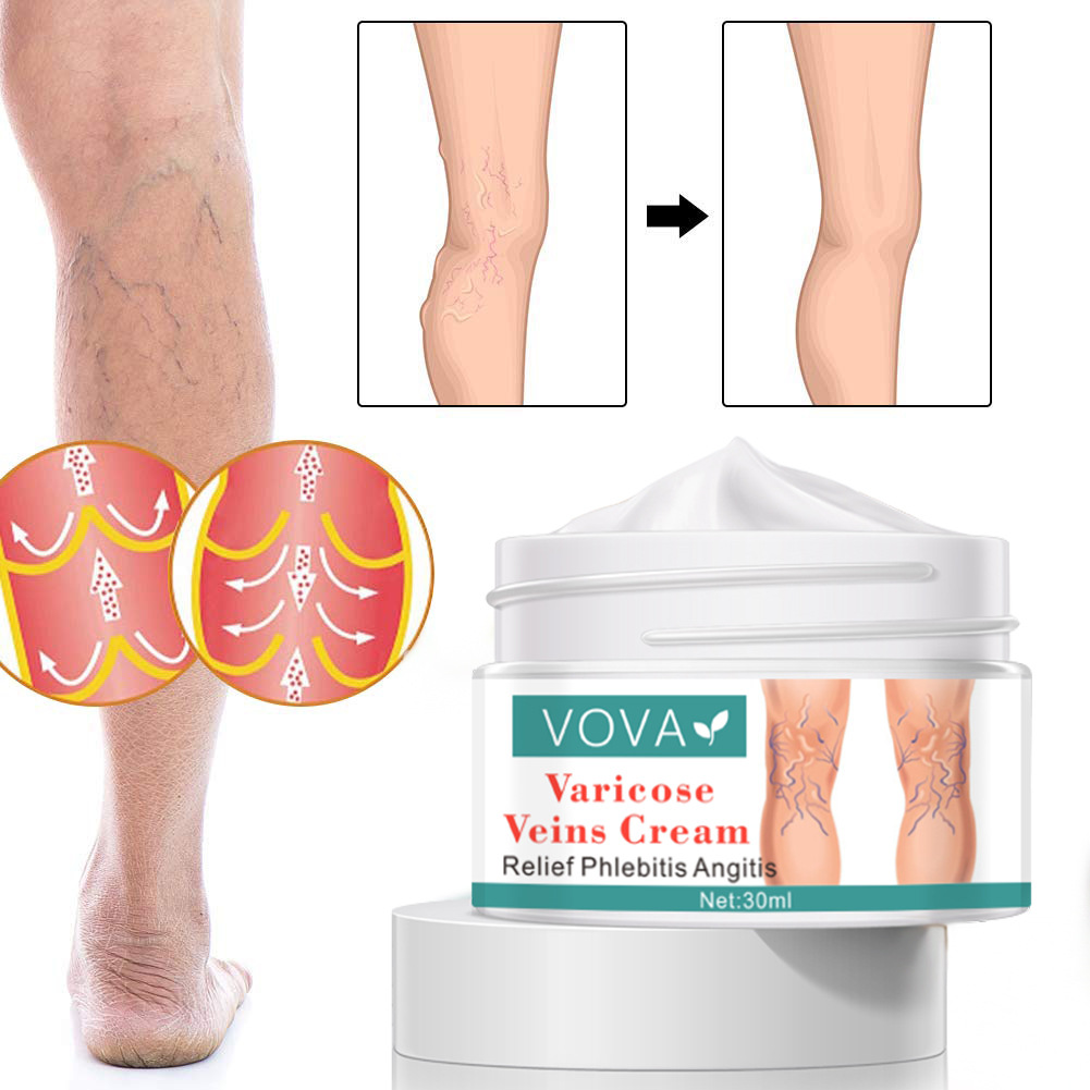 Pregnancy Scar Acne Cream Pregnant Stretch Mark Removal Cream 7 Day Results ESSENTI OIL Skincare Repair