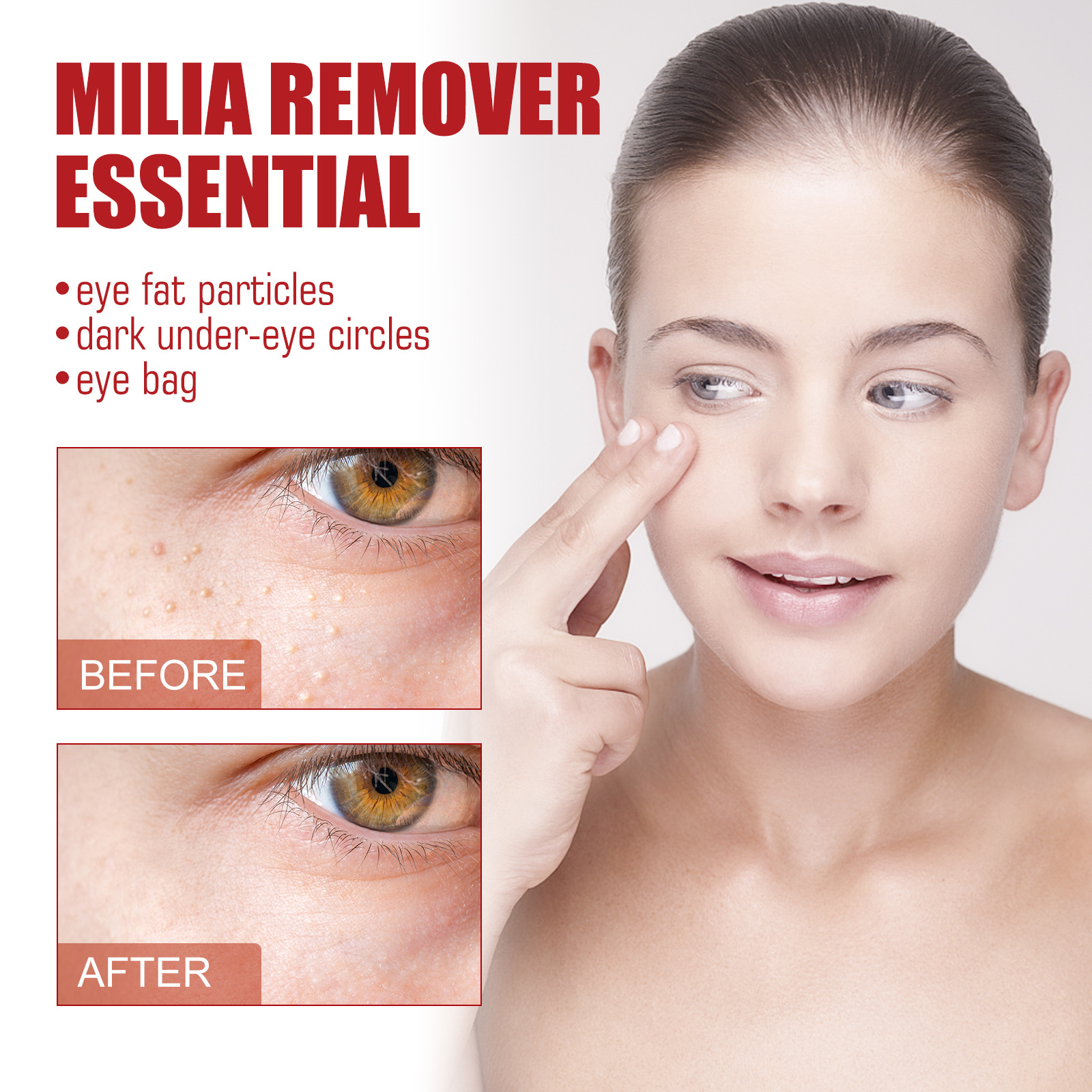 Fat Granules Removal Serum Fade Dark Circles Eye Bags Moisturizing Essence Firming Anti-Puffiness Wrinkles Brighten Beauty Care