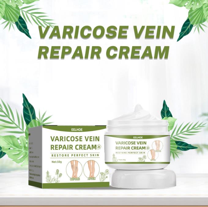 Effective Varicose Vein Relief Cream Eliminate Vasculitis Phlebitis Spider Legs Treatment Soothing Relieve Pain Herbal Ointment