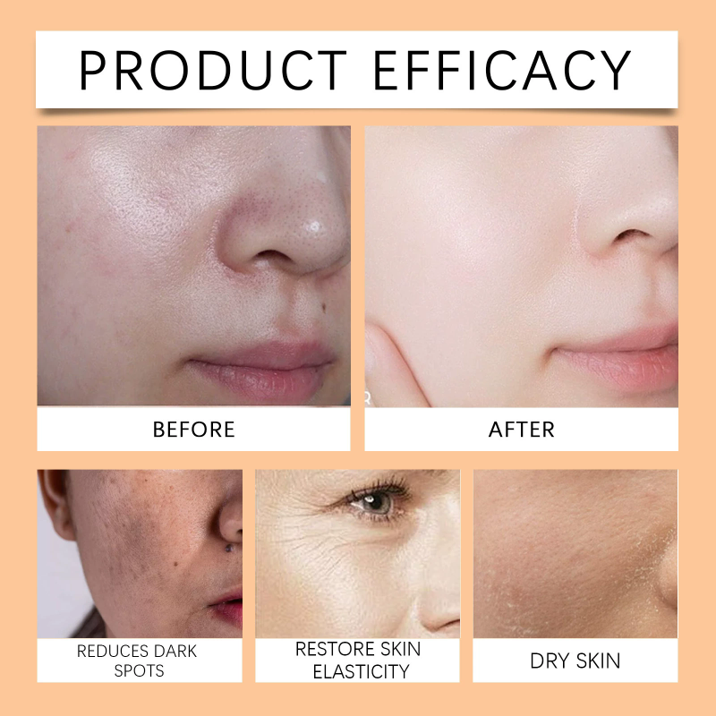 Papaya Whitening Day And Night Cream Anti Freckle Face Cream Improve Dark Skin Refreshing Face Skin 2pcs/set