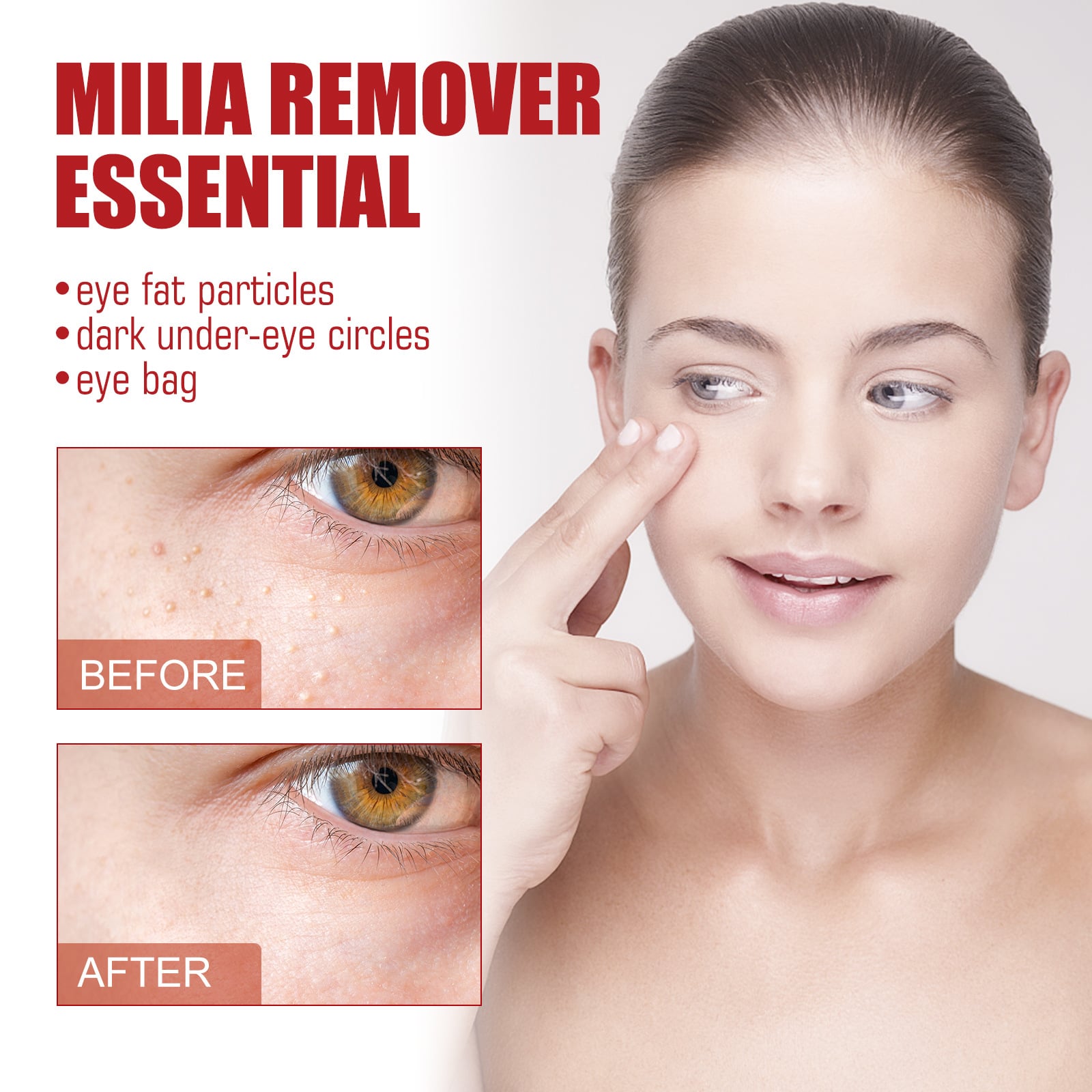Fat Granules Remover Face Serum Fade Dark Circle Reduce Eye Bags Puffiness Anti-Particles Acne Treatment Skin Care Products 30ml