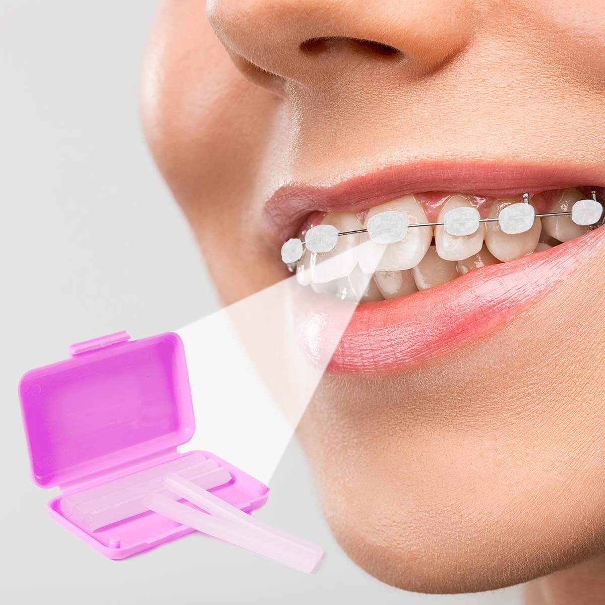 Dental Orthodontic Relief Wax for Bracket Patient Relief Protect Lips and Gums Irritation Fruit Flavour Wax