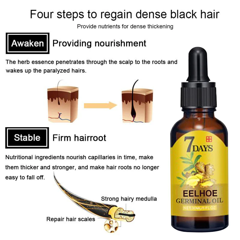 Ginger Hair Growth Fast Hair Growth Essential Oil Beauty Hair Care To Prevent Hair Loss Oil Scalp Care Nutrient Solution