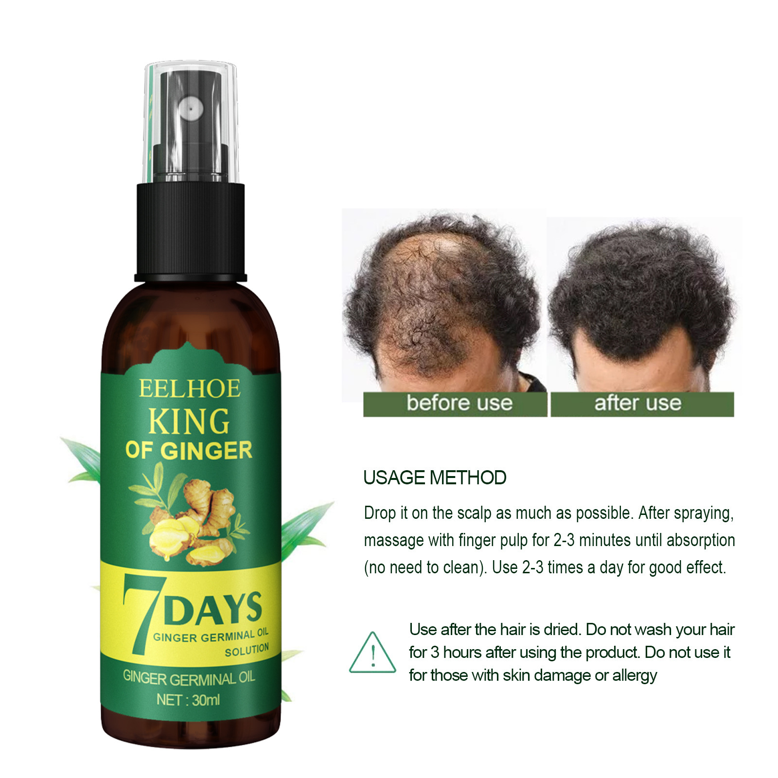 Ginger Hair Growth Products Men's Women's Hair Oil Fast Hair Growth Essence Anti-hair Loss Spray Repair Damaged Hair Care