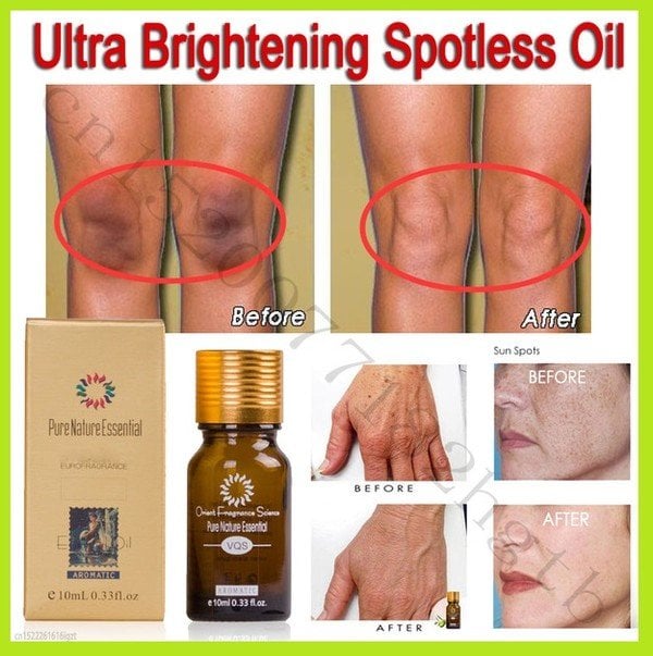 Ultra Brightening Spotless Oil Skin Care Dark Spots Remove Ance Burn Strentch Marks Scar Removal Brightening Skin Essence