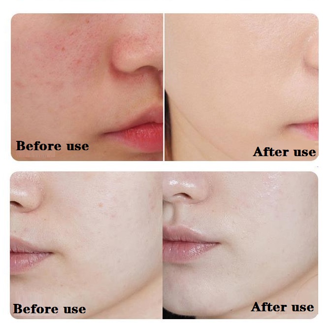The Ordinary Azelaic Acid Suspension 10%