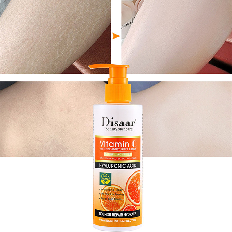 Disaar Vitamin C Body Lotion Moisturizing and Brightening Skin Removing Chicken Skin Body Lotion VC