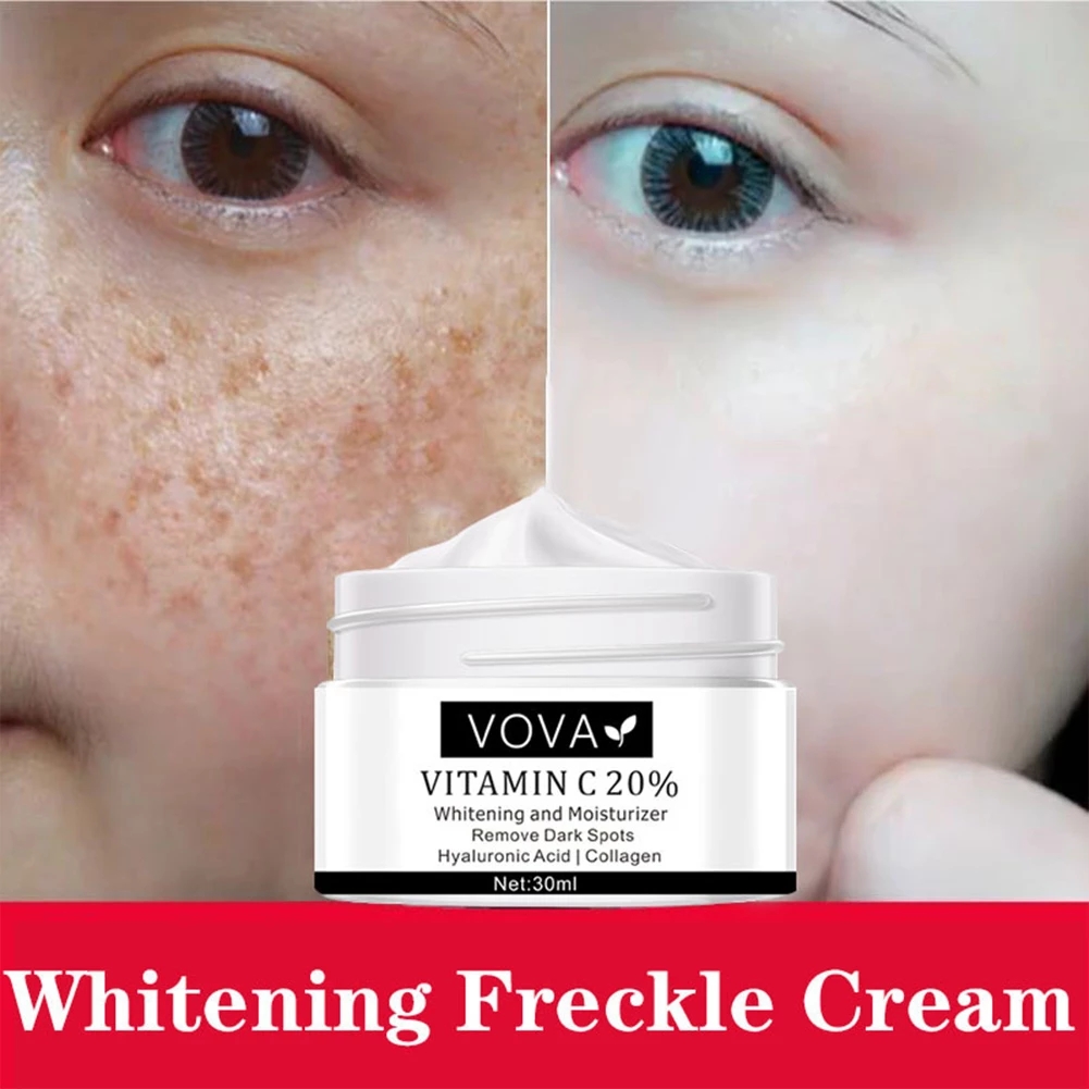 VOVA Effective Whitening Freckle Cream Rich in Vitamin C for Removing Melasma Acne Dark Spots Pigmentation Moisturizing Gel