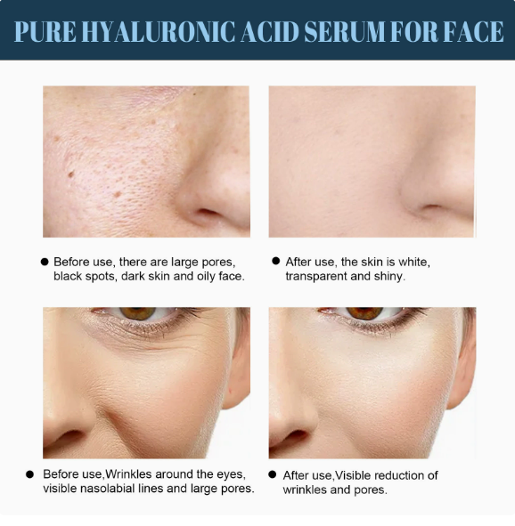 60pcs Gold Protein Line Anti-Wrinkle Firming Facial Filler No Needle Absorbable Fade Fine Lines Collagen Thread Anti-Aging Serum