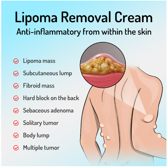 Body Care Cream Reduce Swelling Stimulate Blood Circulation Relieve Body Discomfort Detoxifying Nourishing Leg Repair Ointment