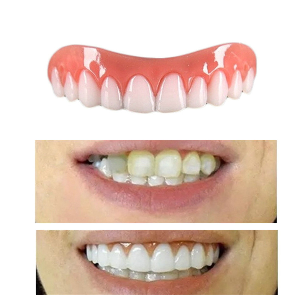 Silicone Simulation Teeth Veneer Smile Perfect Snap Denture Veneer Cosmetic Teeth Cover Whitening Braces