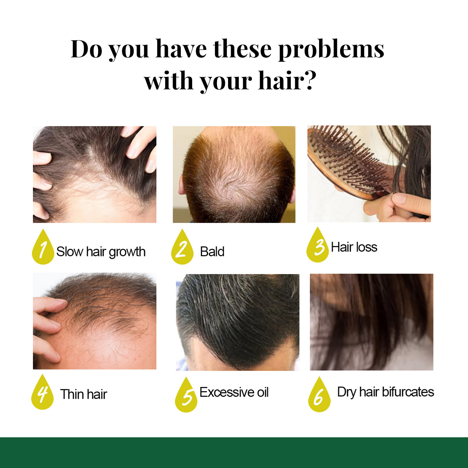 Ginger Hair Growth Products Men's Women's Hair Oil Fast Hair Growth Essence Anti-hair Loss Spray Repair Damaged Hair Care