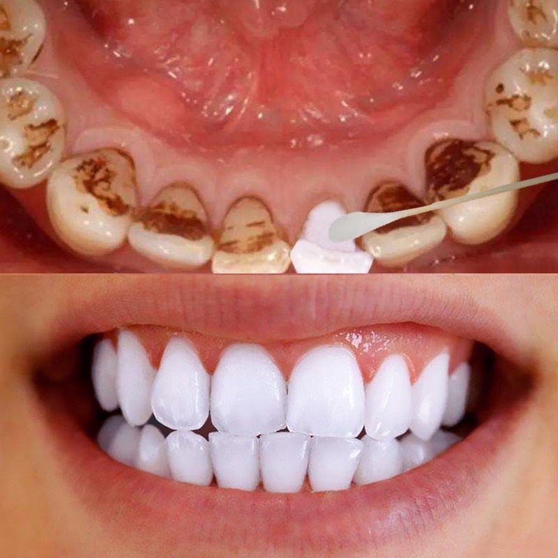 10mlTooth Whitening Powder Activated Coconut Charcoal Natural Teeth Whitening Charcoal Powder Tartar Stain Removal