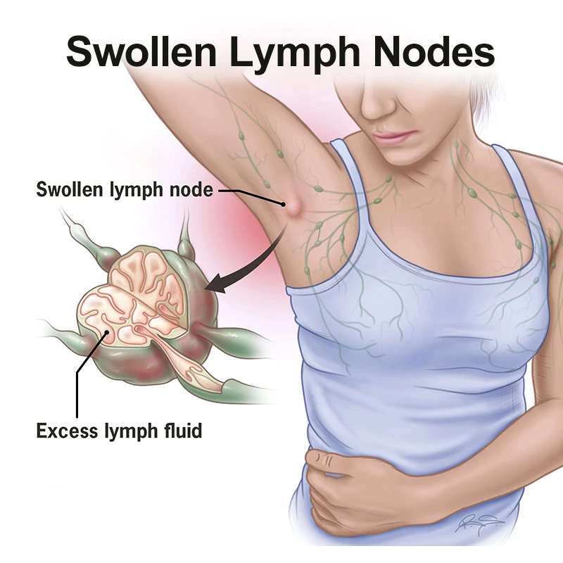10PCS Herbal Lymphatic Detox Patch Neck Anti-Swelling Lymph Node Herbal Pads Medical Plaster Breast Patch Health Care
