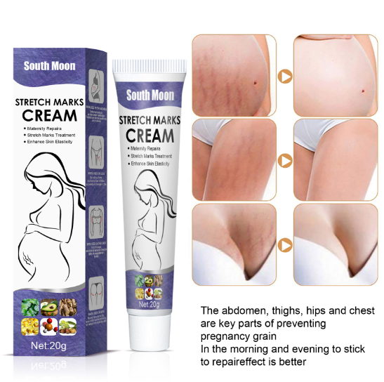 Stretch marks repair cream fat stretch marks repair cream postpartum to pregnant lines mommy cream to desalinate growth lines