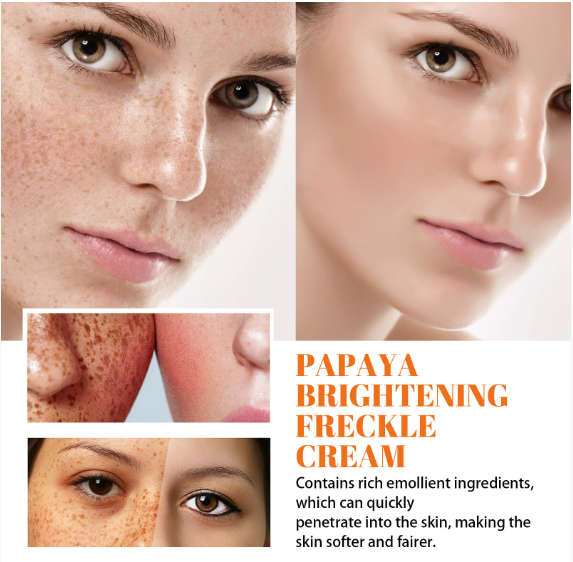 Freckle Whitening Face Cream Papaya Day Night Sun Spots Corrector Fade Pigment Brighten Skin Tone Blemish Bleaching Nourishing