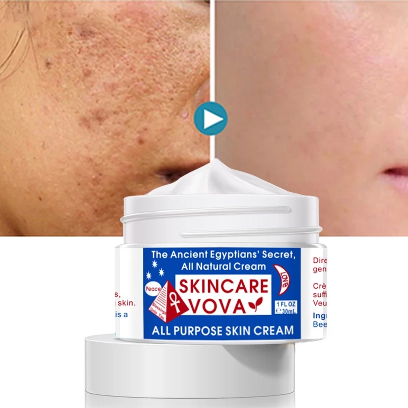 The Ancient Egyptians' Secret All Natural Cream All Purpose Skin Cream Smooth Whitening Skin Facial Cream Anti Aing Face Cream