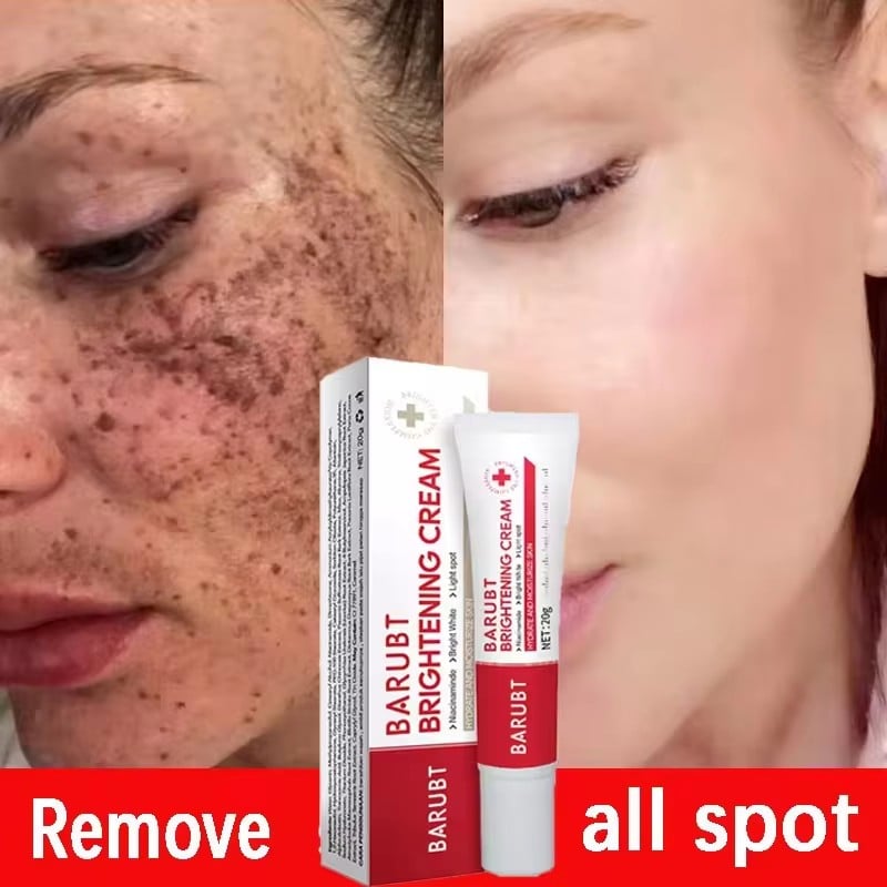 Powerful bleaching cream removing stains, lightens the skin, quickly removes melanin pigmentation, melasma, dark spots