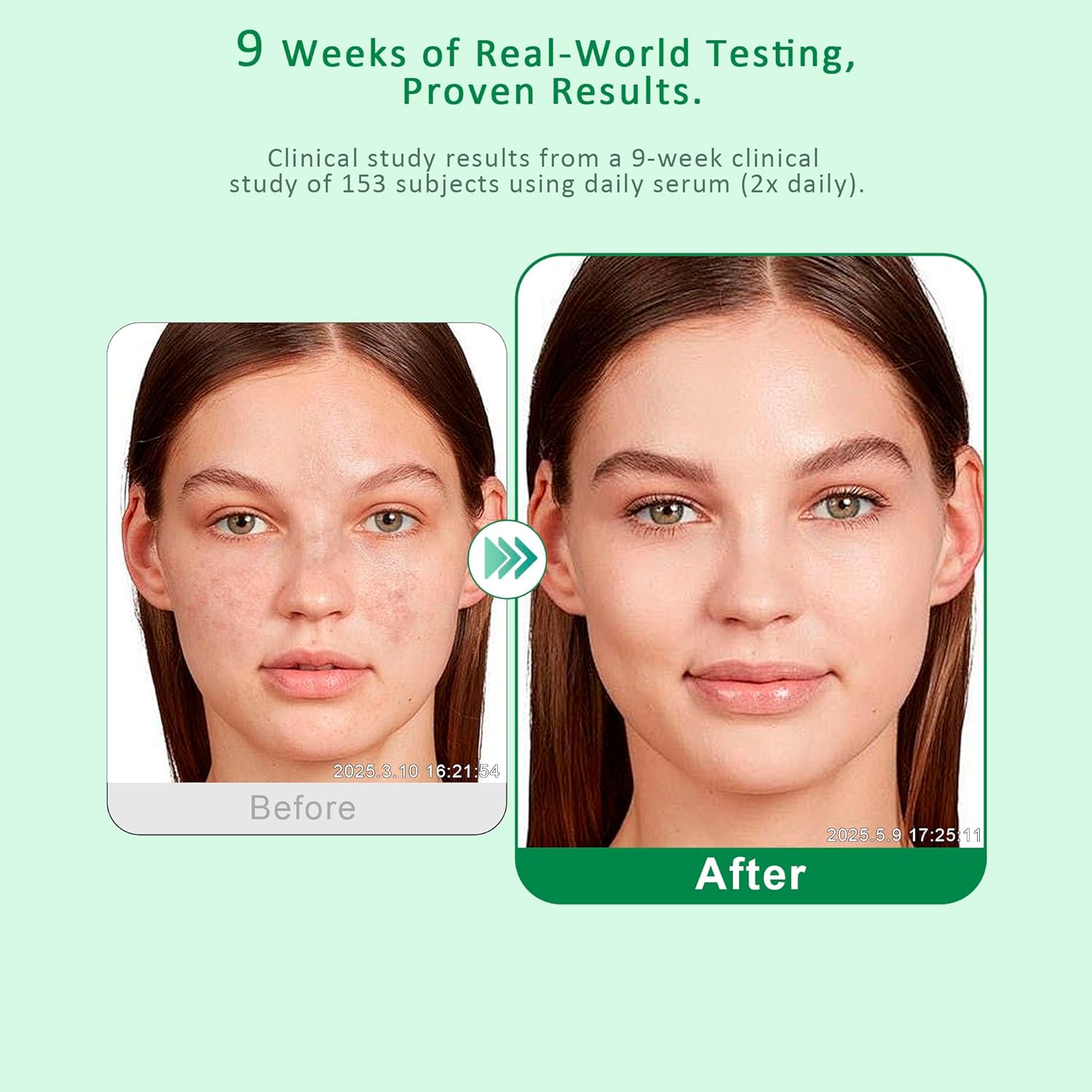 Dark Spot Remover for Face & Body – Dark Spot Corrector Serum for Hyperpigmentation, Brown Spots & Melasma Treatment - 1.7 fl oz