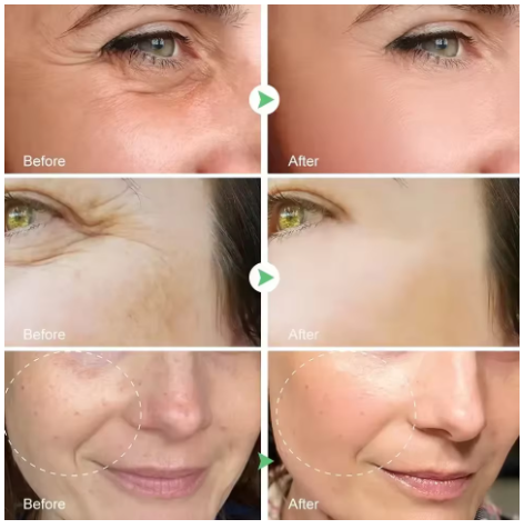 Retinol Remove Wrinkle Face Serum Lift Firming Anti Aging Fade Fine Lines Whitening Brightening Moisturizer Skin Care Cosmetics