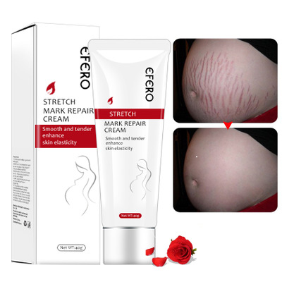 EFERO Postpartum Stretch Mark Cream Removal Scar and Stretch Mark Removal Cream Stretch Mark Cream