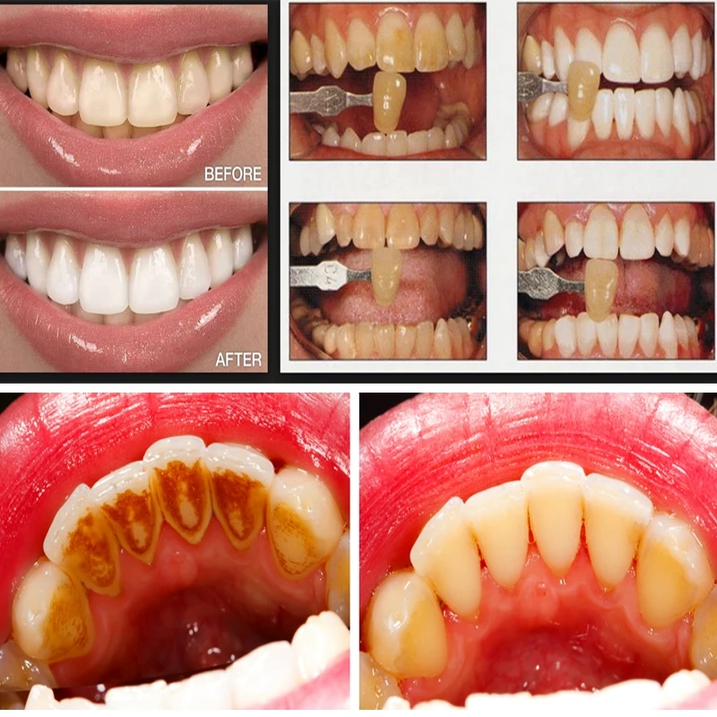 Lasting Teeth Cleansing Whitening Mousse Removes Stains Tartar Teeth Whitening Oral Hygiene Mousse Toothpaste Fresh Bad Breath