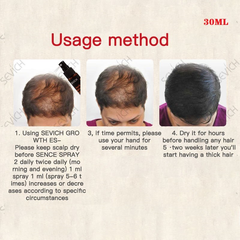 30Ml Haargroei Vloeibare Spray Helpen Voor Haargroei Haaruitval Behandeling Beschadigd Haar Reparatie Groeiende Haargroei