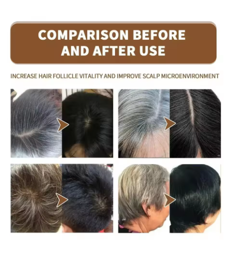 Gray White Hair Treatment Serum Cover White Hair To Black Natural Color Repair Spray Anti Loss Hair Restore Healthy Hair Care