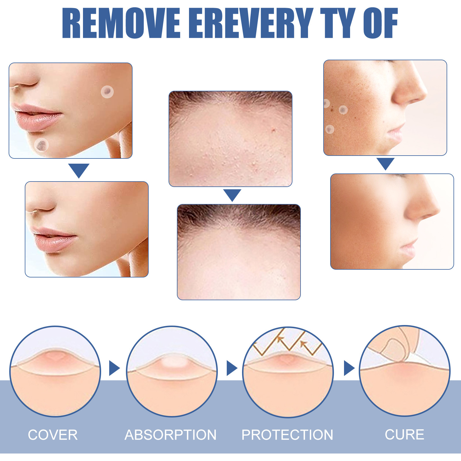 Wart Removal Treatment Antibacterial Ointment Papillomas Removing Skin Labels Flat Wart Genitals Painless Beauty Herbal Cream