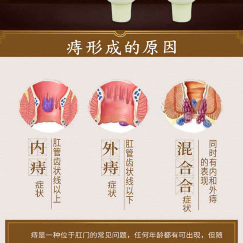 Hemorrhoids Ointment Sterilize Cream For Internal Hemorrhoids Piles Pain Relief External Anal Fissure Therapy