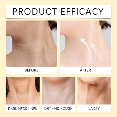 Bee Venom Lifting Neck Cream Deep Moisturizing Face Repair Skin Barrier Smooth Hydrated Skin Firming Tightening Cream 50g