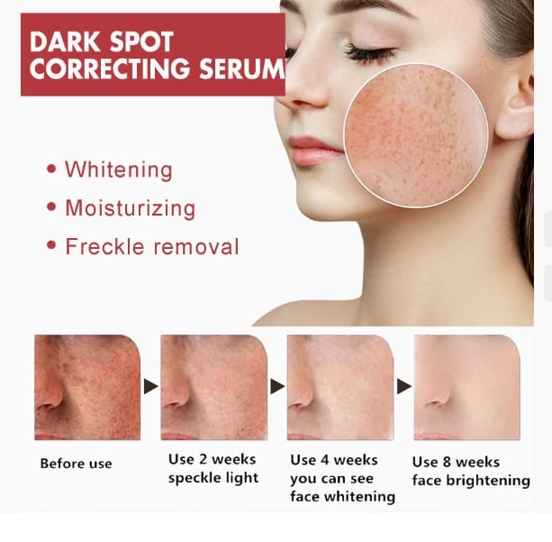 Niacinamide Serum Melanin Removal Fade Melasma Dark Spots Corrector Shrink Pores Hyaluronic Acid Moisturizing Korea Skin Care