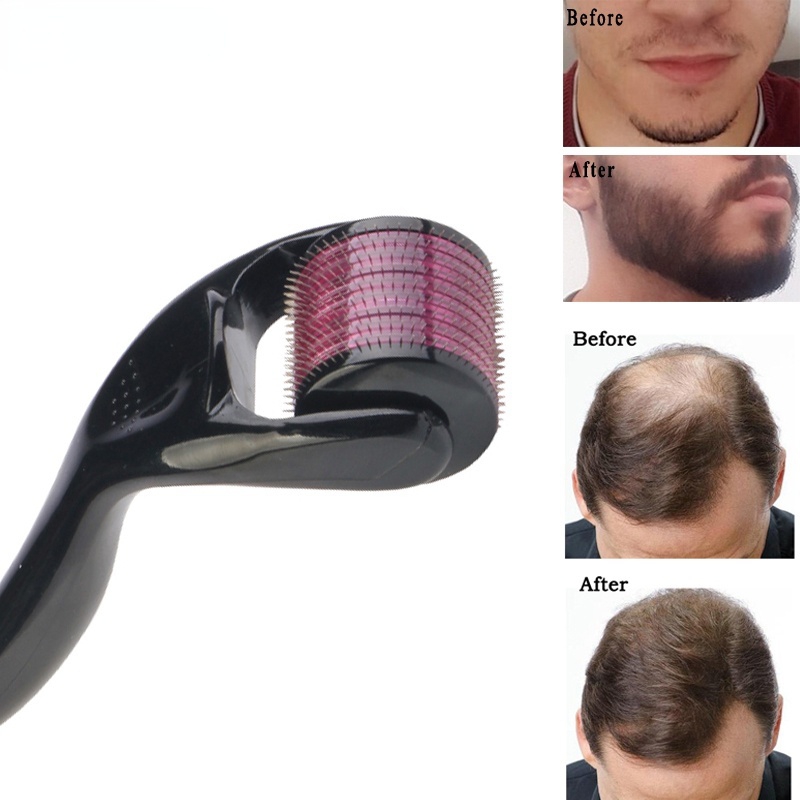 Micro Needling 540 Roller Derma Roller Dermaroller 0.3mm Titanium Hair Regrowth Beard Growth Anti-Hair Loss Treatment