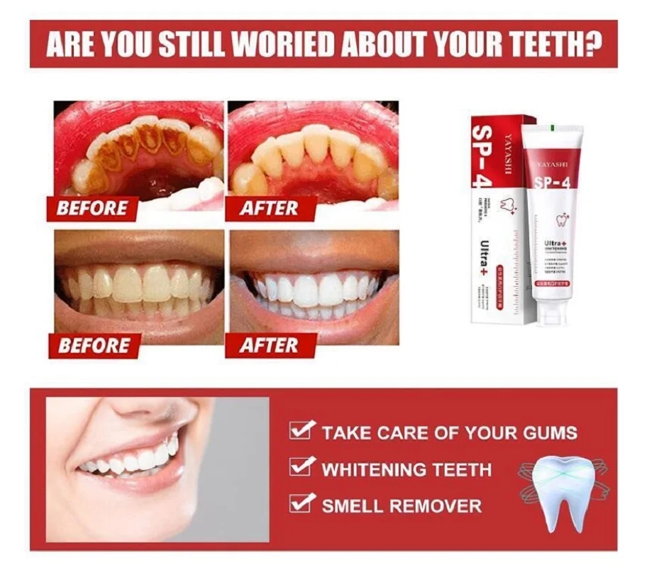 120g Probiotic Whitening & Stain Removal Toothpaste Brighten Teeth Fresh Breath Improve Yellow Teeth Family Pack for Men & Women
