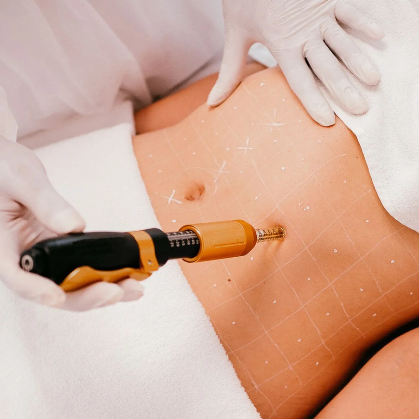 Caneta Mesoterapia Pressurizada Manual Para Intradermoterapia Facial E Corporal