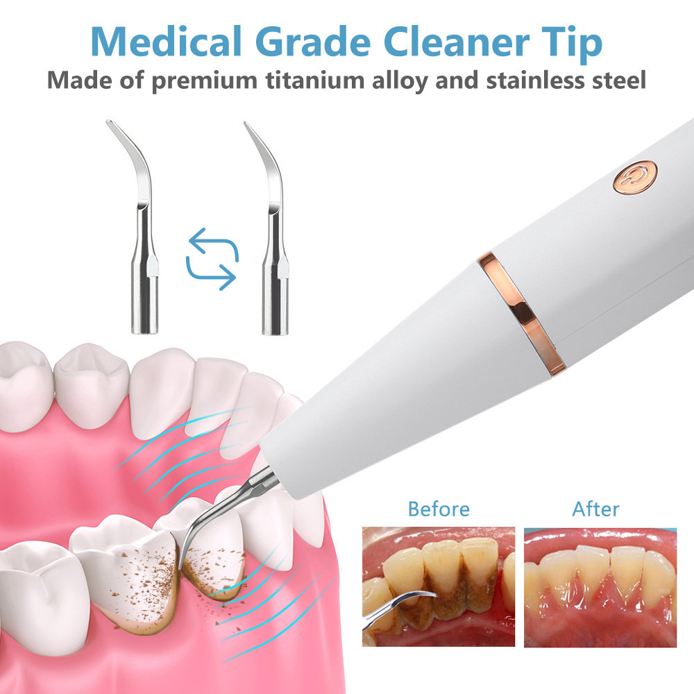 Ultrasonic Dental Scaler For Teeth Tartar Stain Tooth Calculus Remover Electric Sonic Teeth Plaque Cleaner Dental Stone Removal