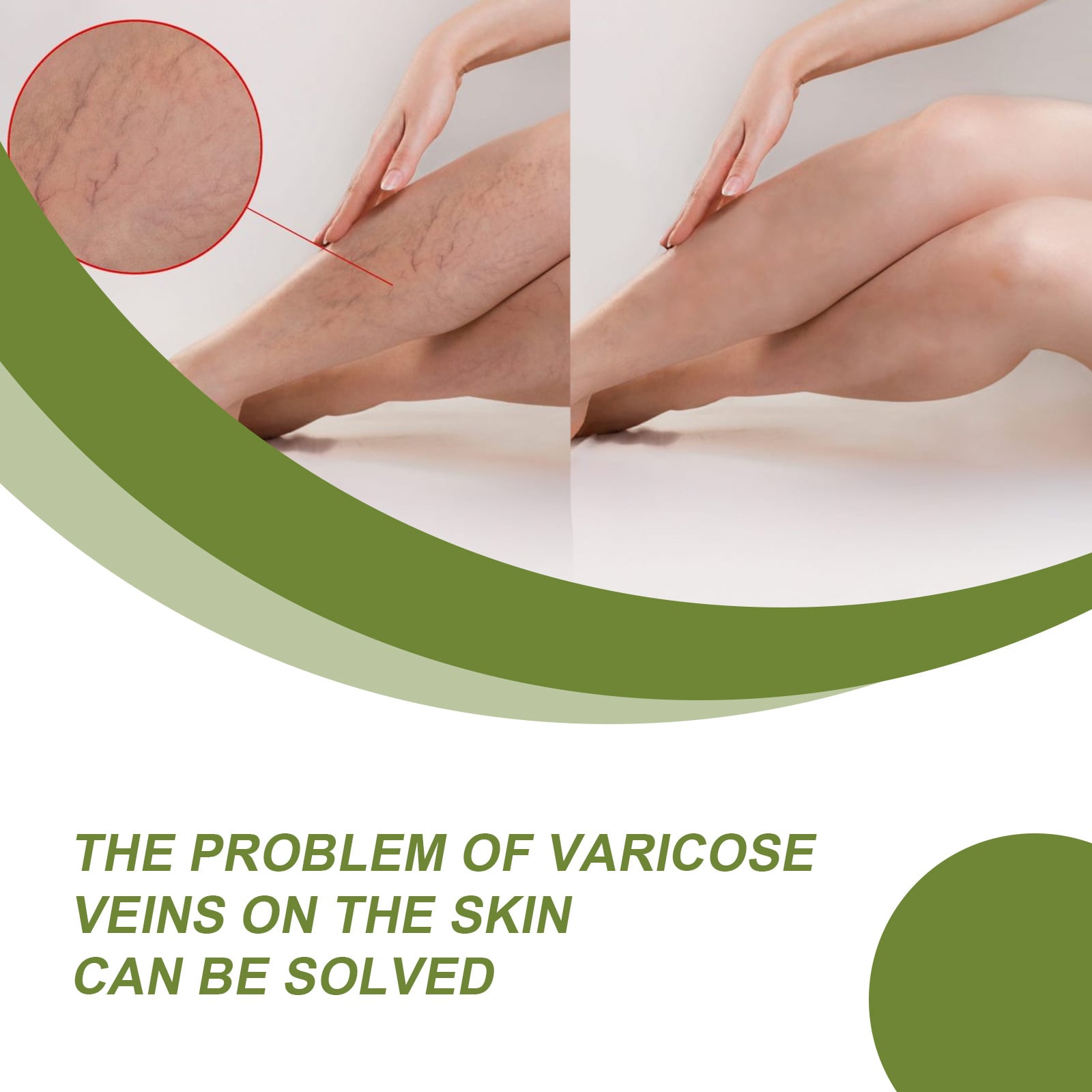 Varicose Vein Repair Cream Tongmai Effective Relieves Leg Bulge Pain Treatment Cream Vasculitis Phlebitis Remove Vein 50g