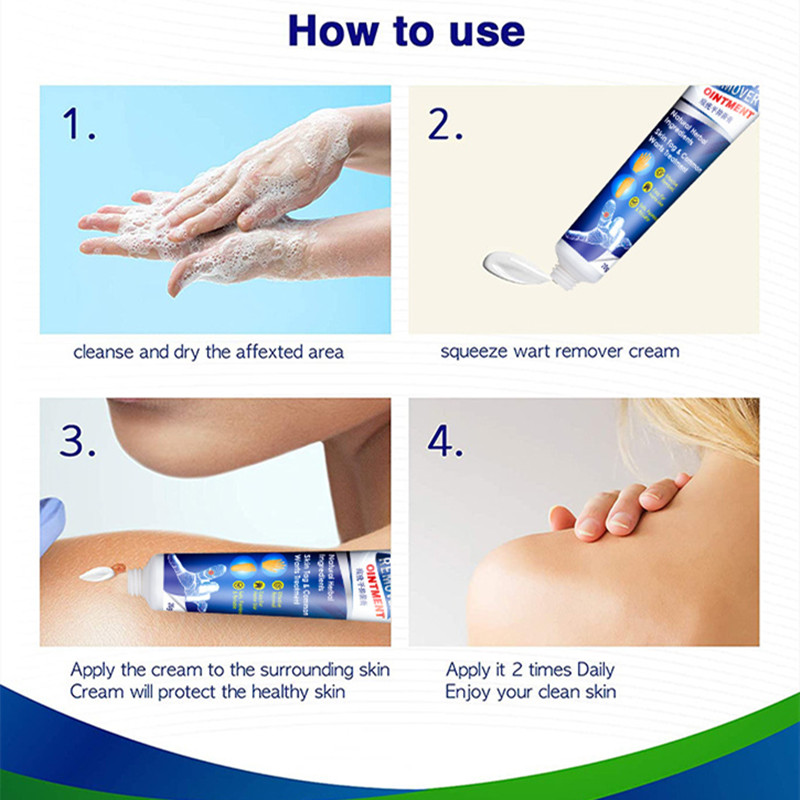 Skin Tag Wart Removal Treatment Neck Facial Foot Wart Removal Cream Target Mole Ointment Wart Removal Medical Plaster