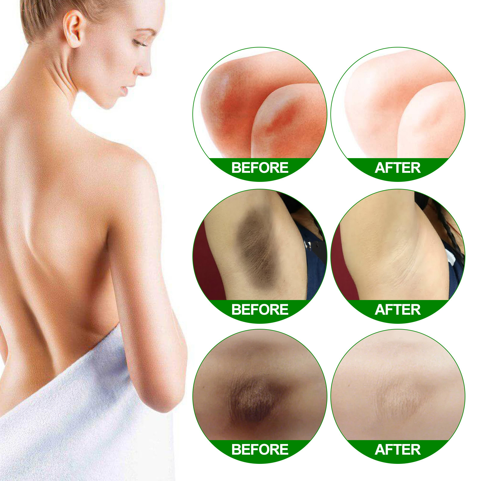 Body Whitening Cream Fast Bleach Private Parts Lighten Underarm Legs Knees Melanin Intimate Areas Remove Dark Spot Beauty Health