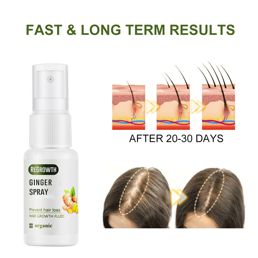 Regrowth Ginger Spray Fast Hair Growth Fluid Anti Loss Treatment Ginger Essence Prevent Hair Loss Regrowth Ginger Spray Eelhoe