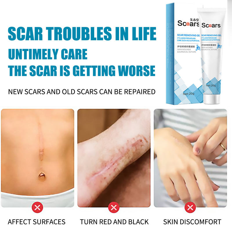 Herbal Scar Removal Cream Gel Repairing Pock Mark Burn Surgical Scar Cesarean Scar Stretch Marks Smooth Moisturizing Skin Care