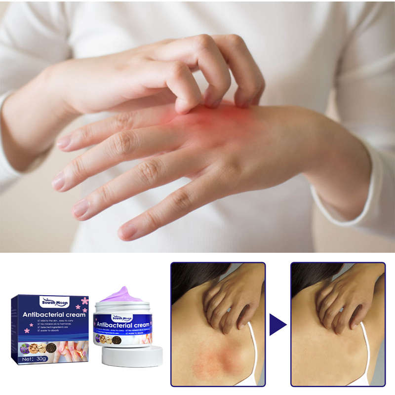 Psoriasis Dermatitis Eczematoid Eczema Ointment Anti-Itch Chinese Herb Medical Skin Care Cream