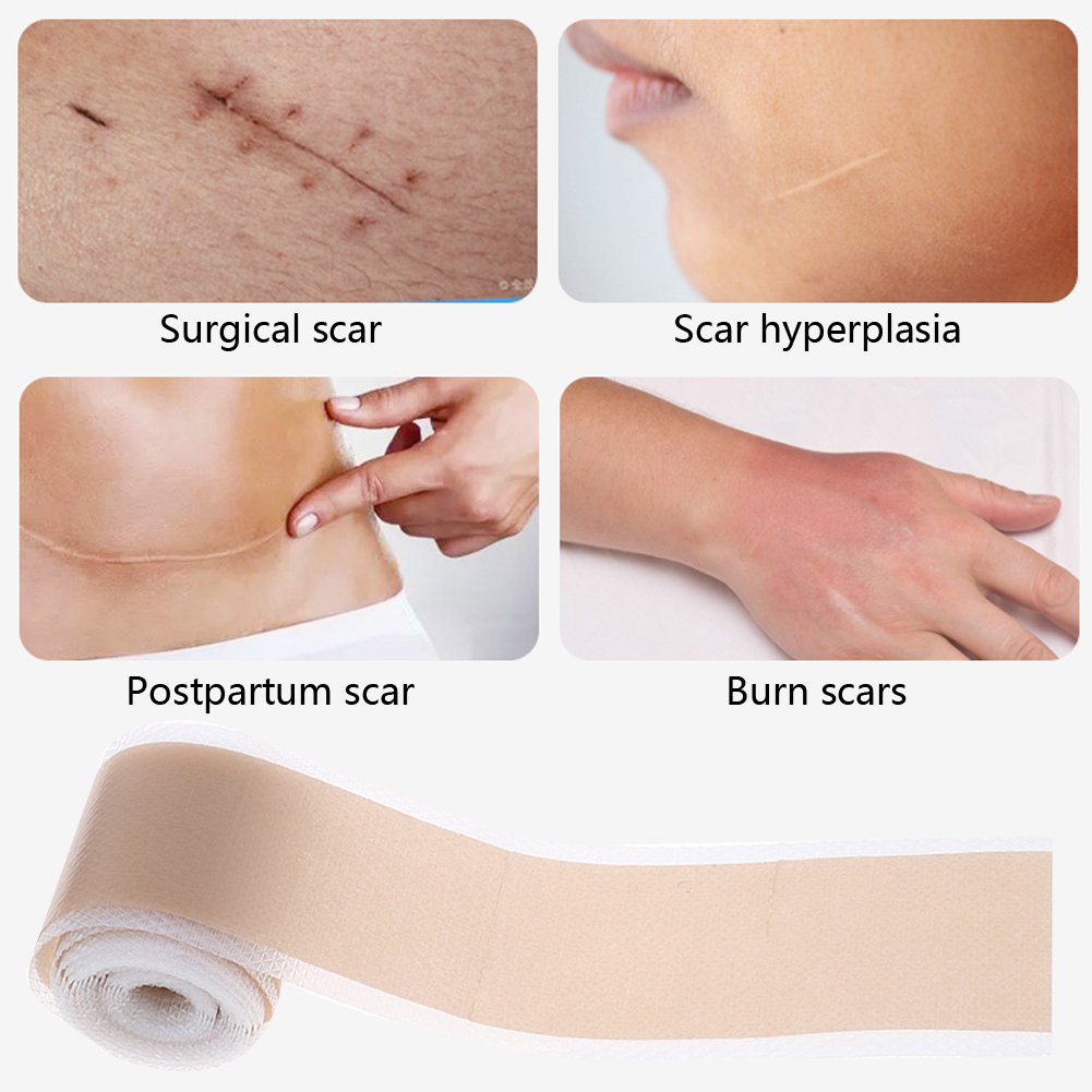 Efficient Beauty Scar Removal Silicone Gel Self-Adhesive Silicone Gel Tape Patch for Acne Burn Scar Reduce Repair Scar Treatment