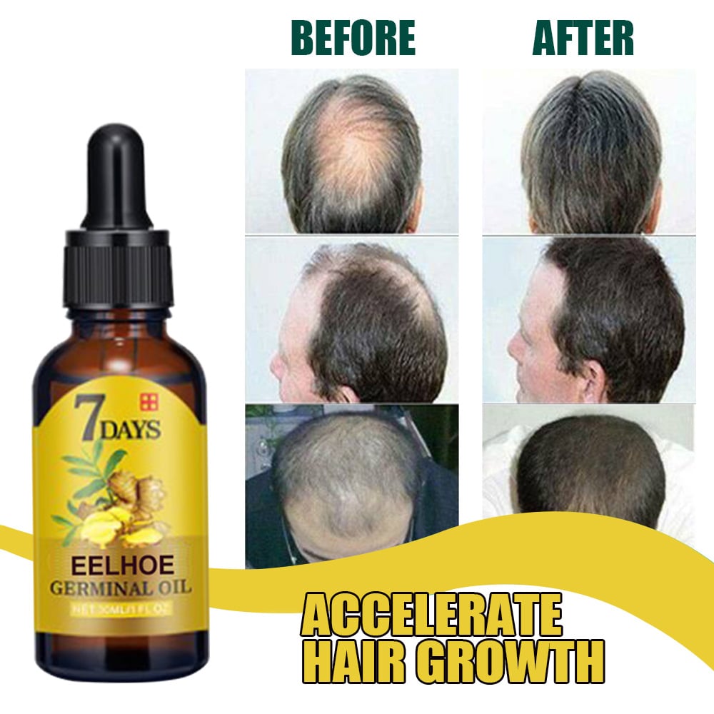 7 Day Fast Hair Growth Essential Oil Effective Hair Loss Treatment Regrowth Ginger Serum Hair Health Care Beauty