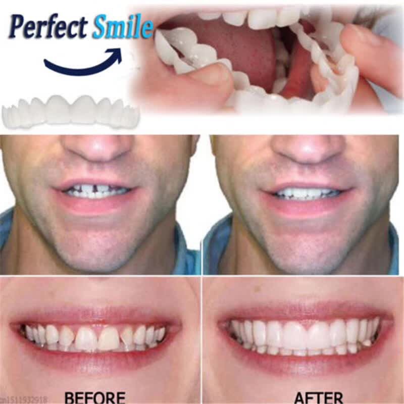 Beautiful Smile Denture Care Creative Teeth Temporary Anti-false Denture