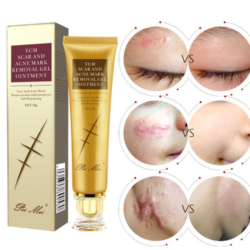 Peimei Peimei light scar cream can lighten the bumps and scars of pregnancy cesarean section without scar gel gel