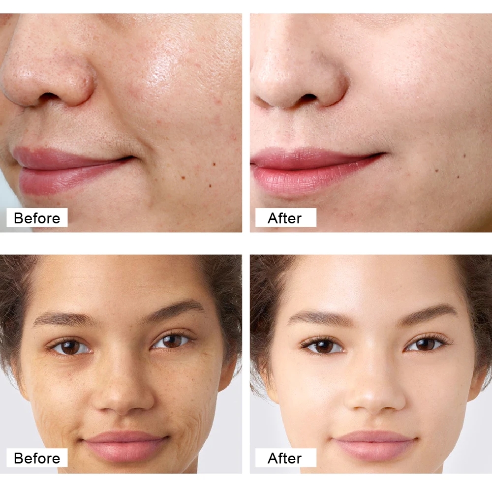 Retinol Wrinkles Removal Cream Anti Aging Firming Lifting Skin Care Hyaluronic Acid Moisturizing Whitening Brighten Cosmetic