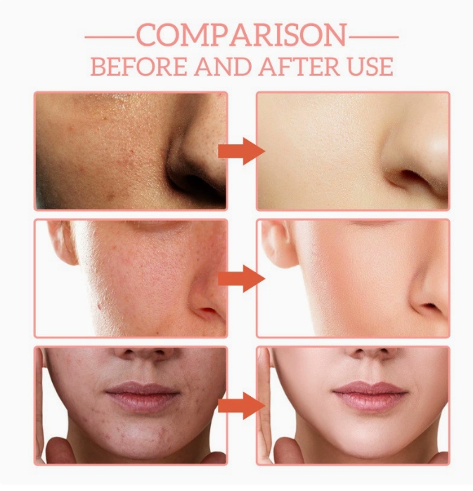 5 In 1 Hyaluronic Acid Face Serum Moisturizing Vitamin C collagen Lightning Facial Serum Shrink Pores Skin Care